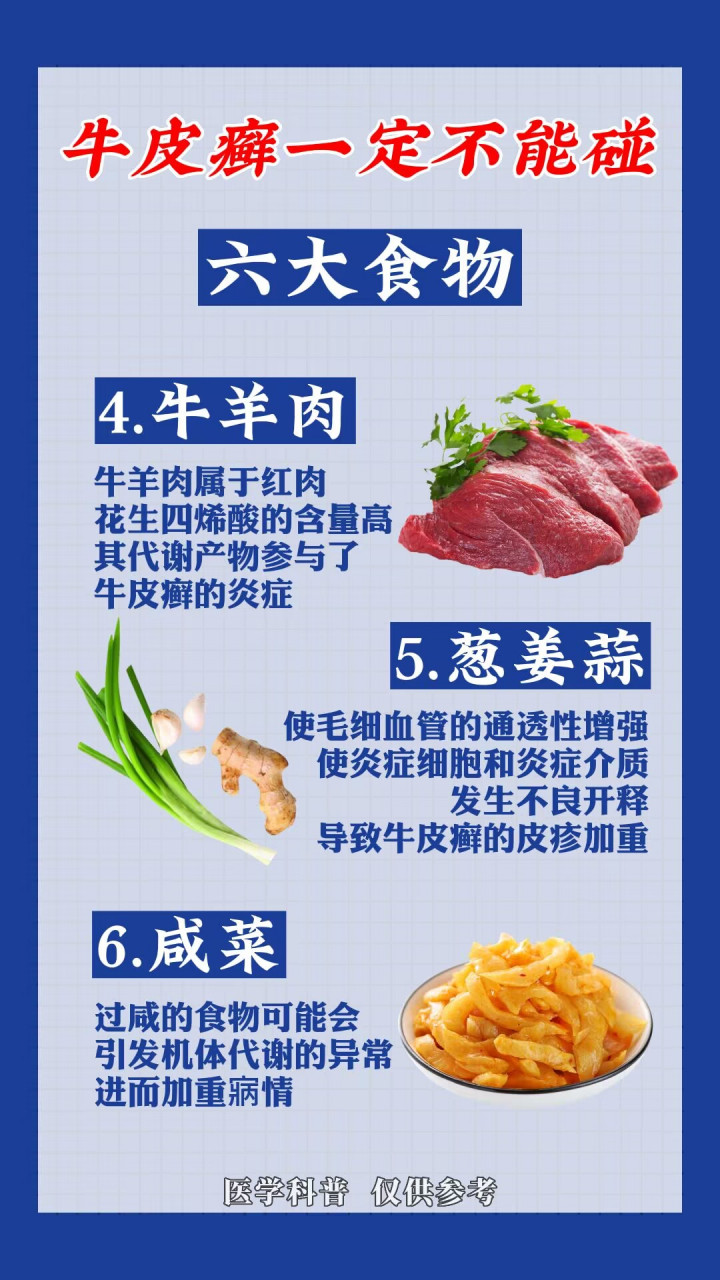 牛皮癣不能吃的六大食物  #牛皮癣# #银屑病牛皮癣# #皮肤# #健康