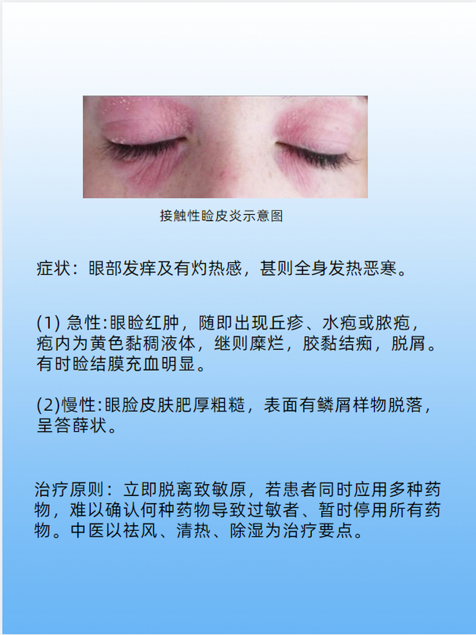 什么是接触性睑皮炎呢?