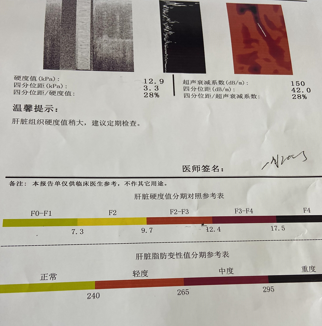 3:肝硬度正常  2.数值在7.3-9.7:存在肝纤维化的可能  3.数值在9.