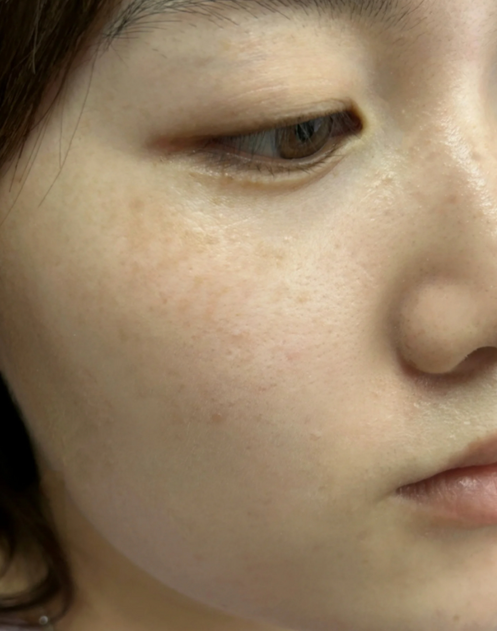 然而,不必担心,我们可以采取一些有效的方法来去除晒斑,并重拾明亮