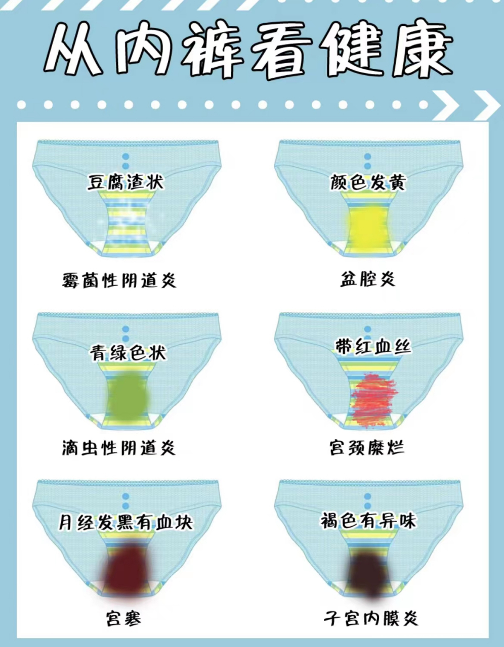 这些小毛病从内裤就能看出来!  #女性健康# #宫颈炎# #白带异常