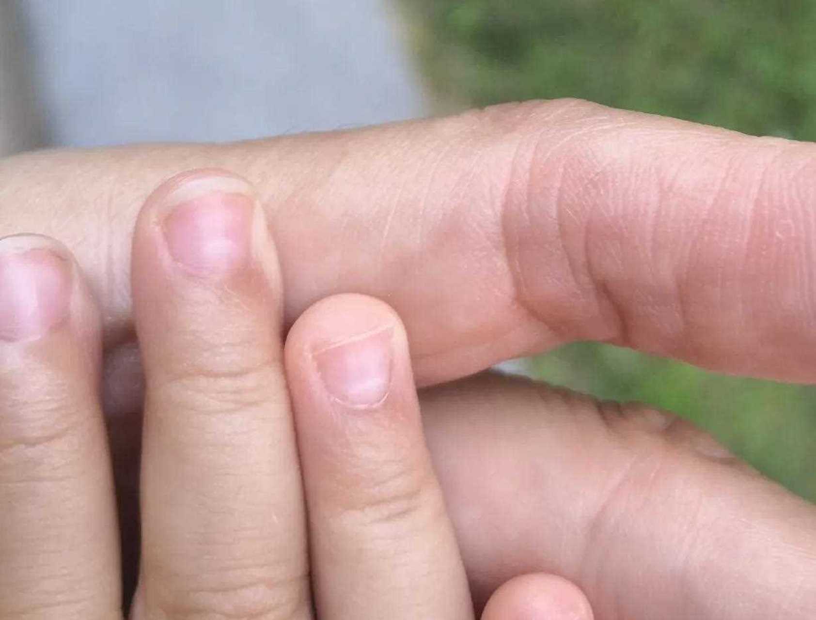 今天给宝宝剪指甲发现指甲盖上有白色的横纹