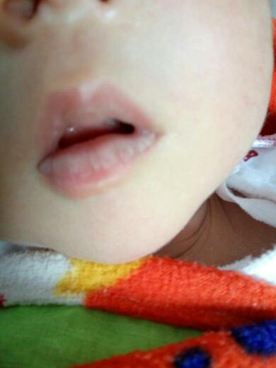 的泡怎么办小孩嘴唇发白图片新生儿在婴幼儿时期的宝宝嘴唇发白的话