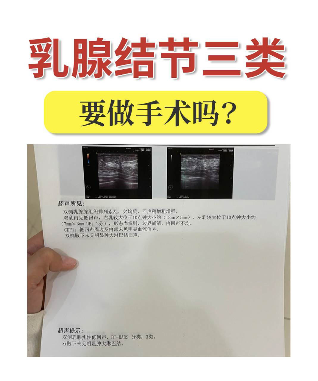 乳腺结节三类一般不用做手术.