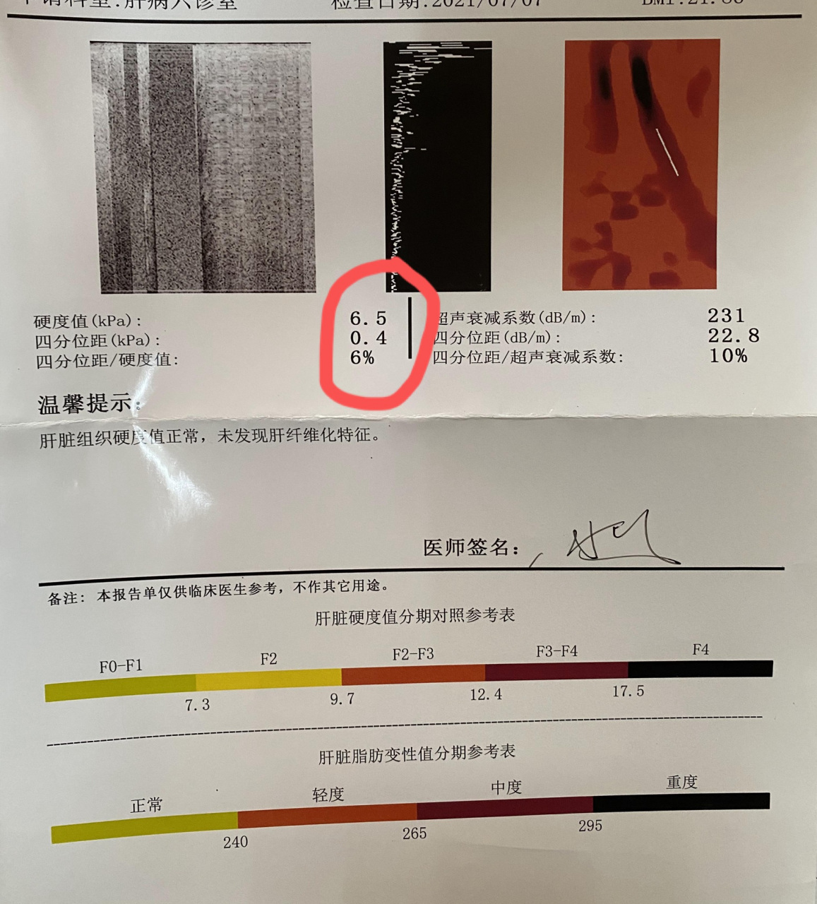 肝弹检查是什么?有什么作用?  大家好,我是肝病科医生马瑞萍.