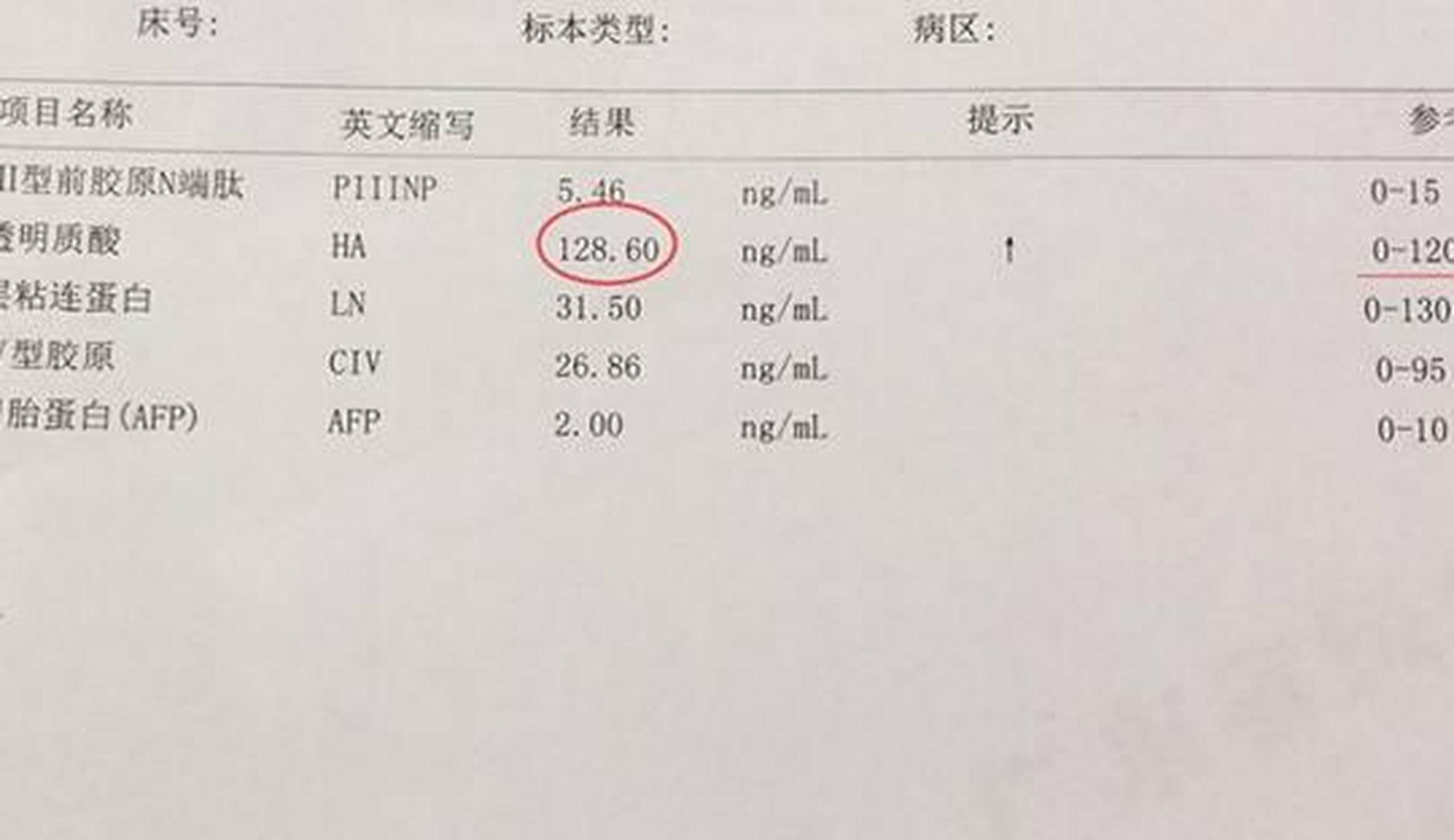 肝纤四项 结果呈阳性,提示肝纤维化;1项指标升高,提示可能肝脏纤维