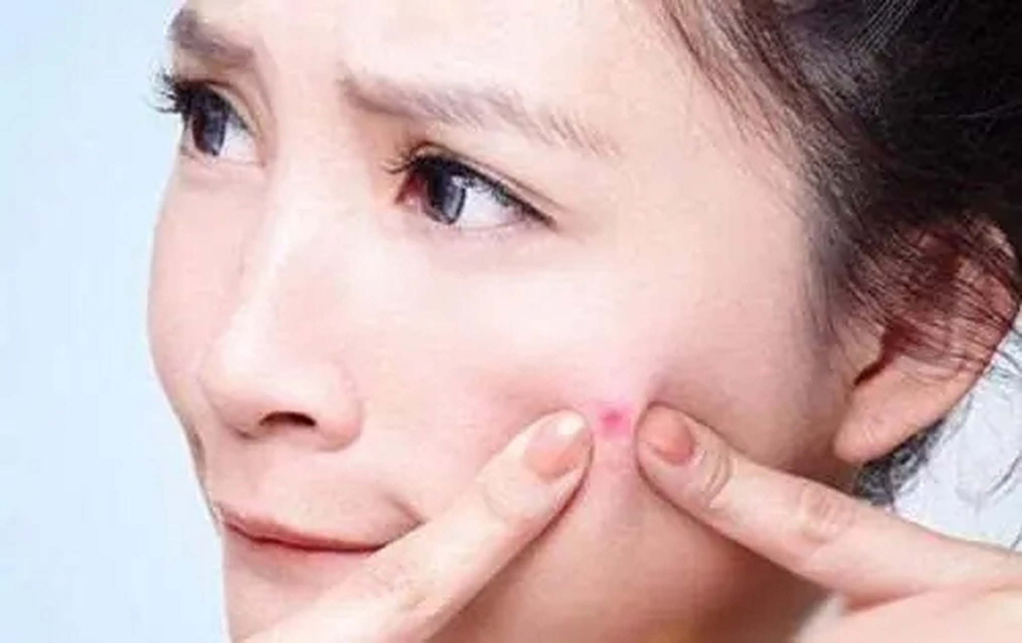 【脸上有痘痘千万不要抠挠】  不经意地抠挠,触摸,摩擦或揉捏面部等小