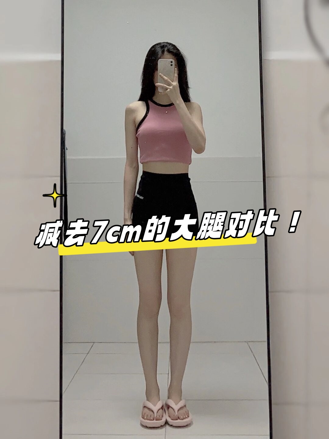 我曾经的大腿围是52cm小腿围是35cm体重为92