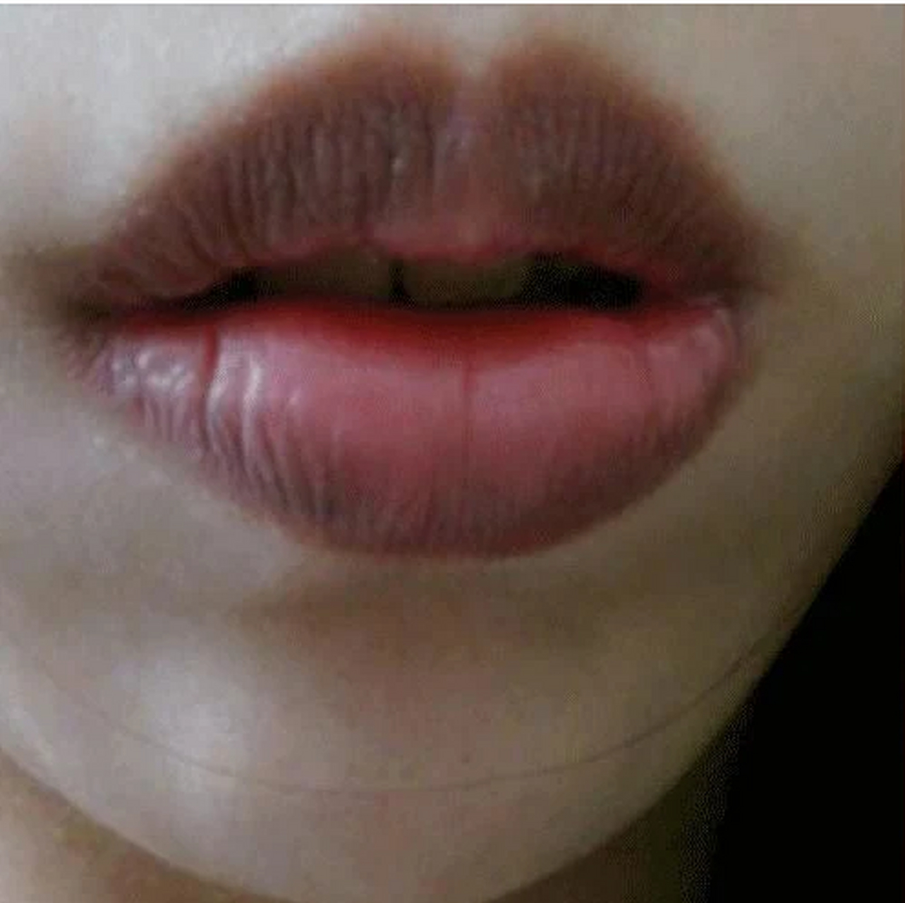 为什么嘴唇发黑 为什么嘴唇发黑