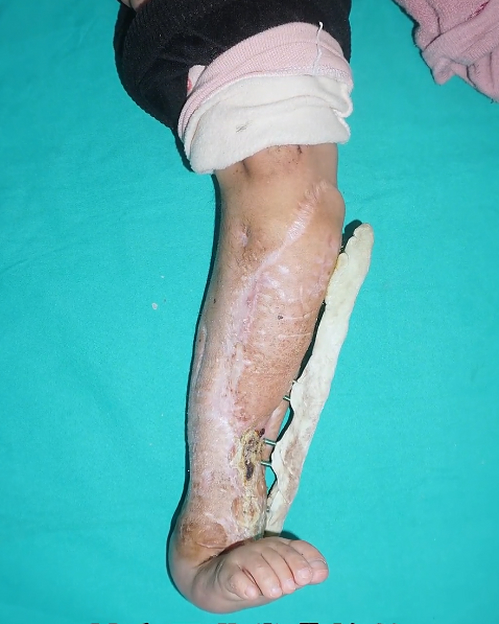 这个小朋友的经历让人潸然泪下,小