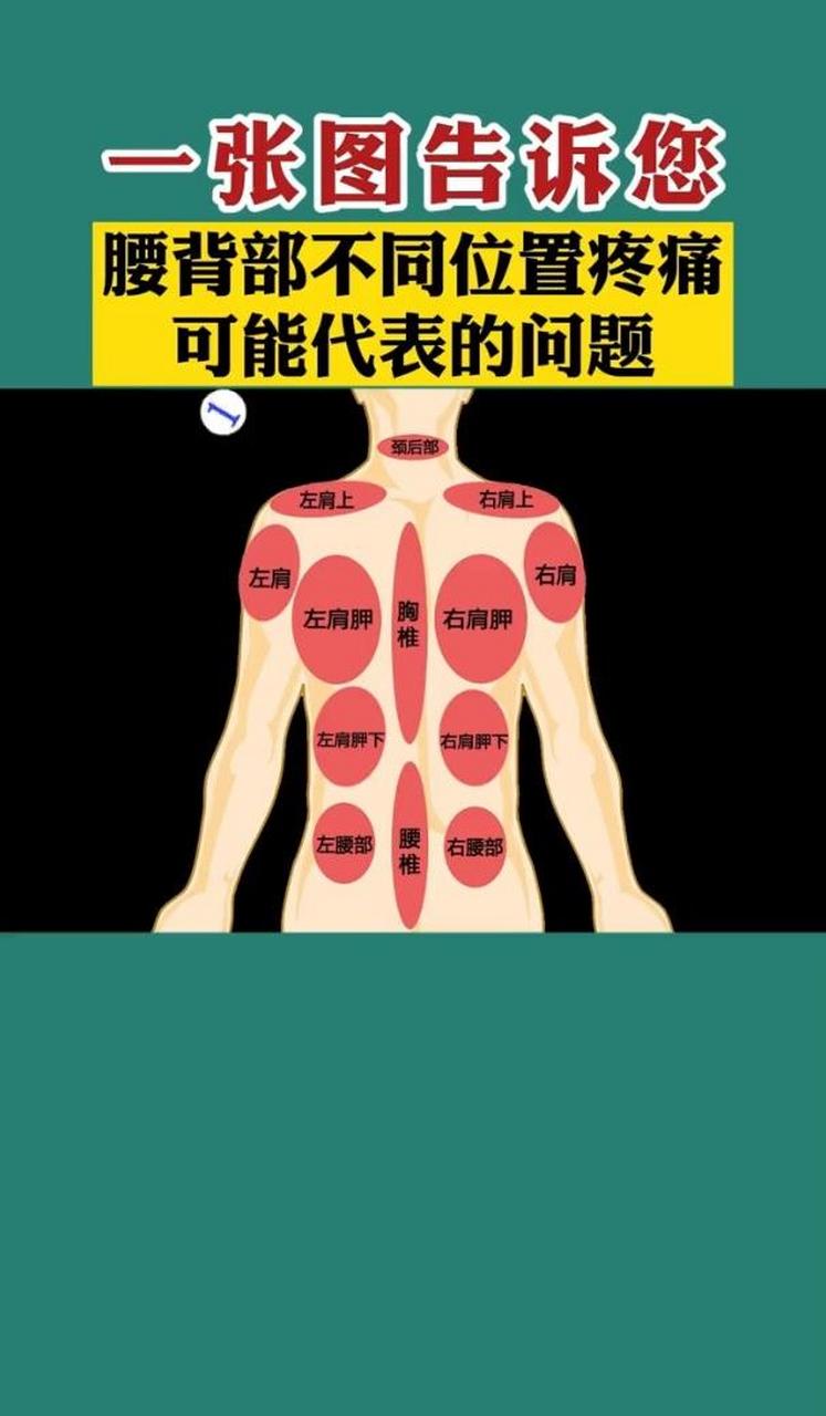 腰背部这4处疼,是身体在报警 左背疼:有可能是心脏疾病,肩周炎颈椎病