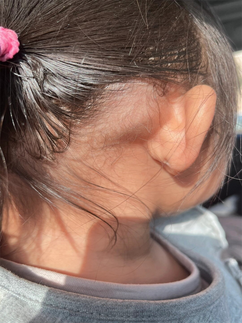 宝宝头上突然起了个大包  原文:早上梳头还没有,刚