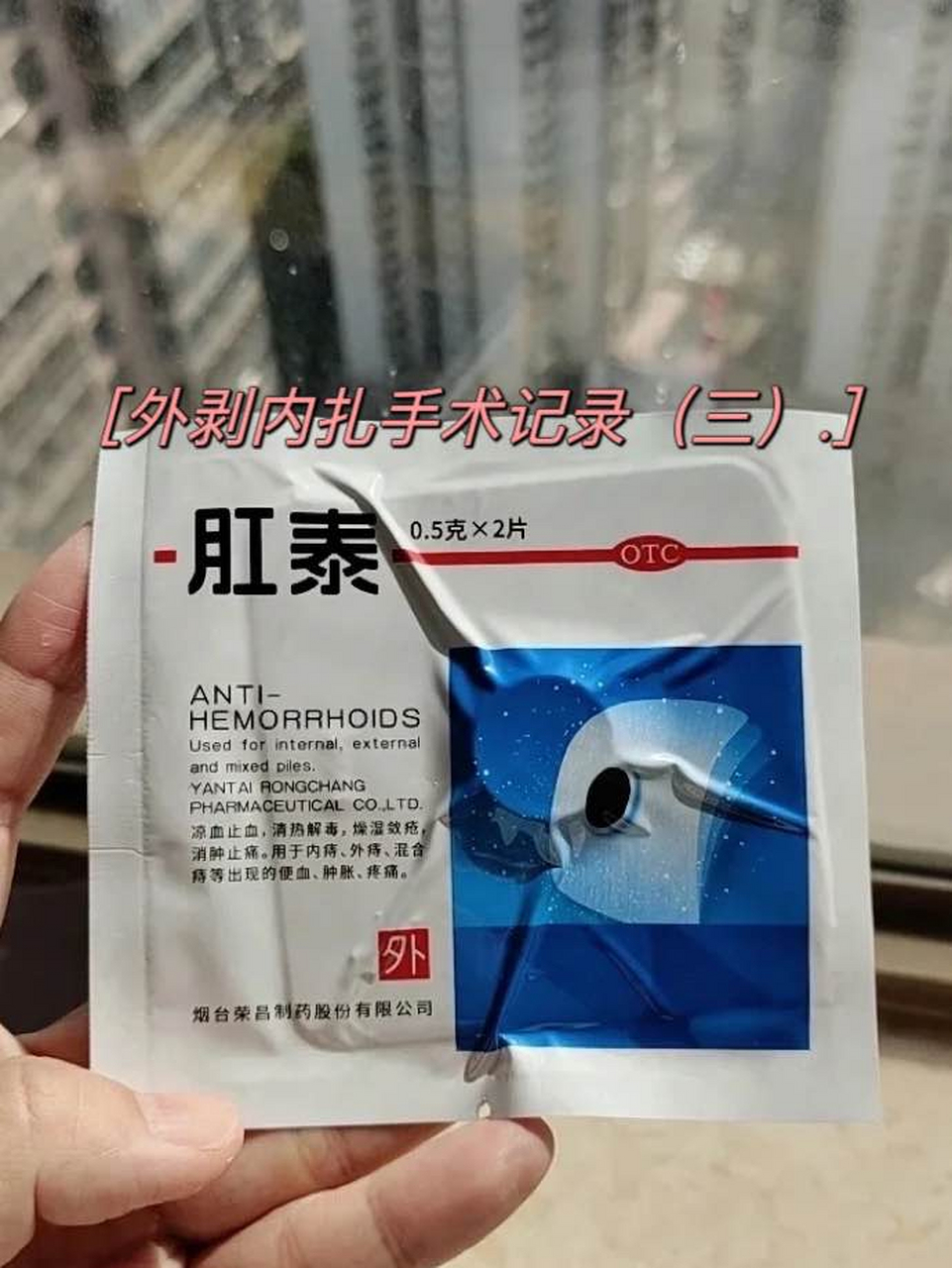 外剥内扎手术记录(三)  手术第三天 其实基本没有痛苦了,除了上厕所有