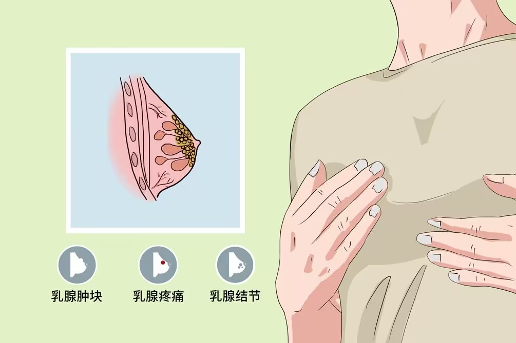 乳腺增生怎么治最好 乳腺增生属于严重的内分泌失调