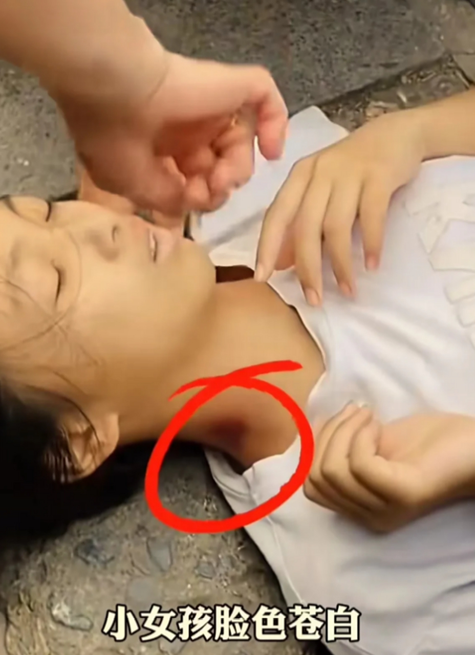 在重庆,一位小女孩因中暑晕倒在路边,然而路人都不敢扶她.