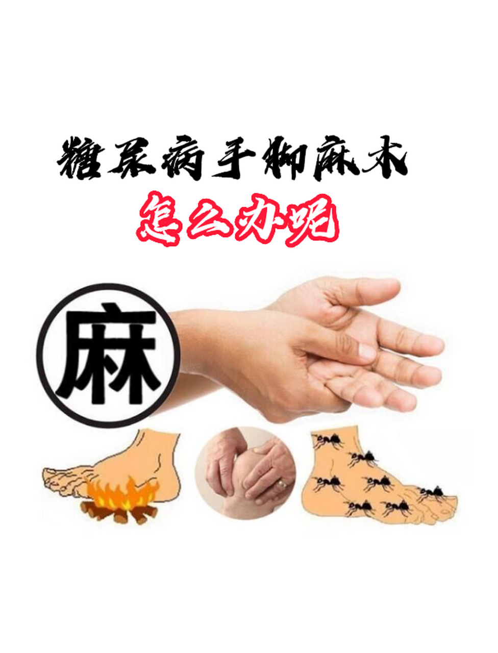 糖尿病的手脚冰凉麻木怎么办呢?