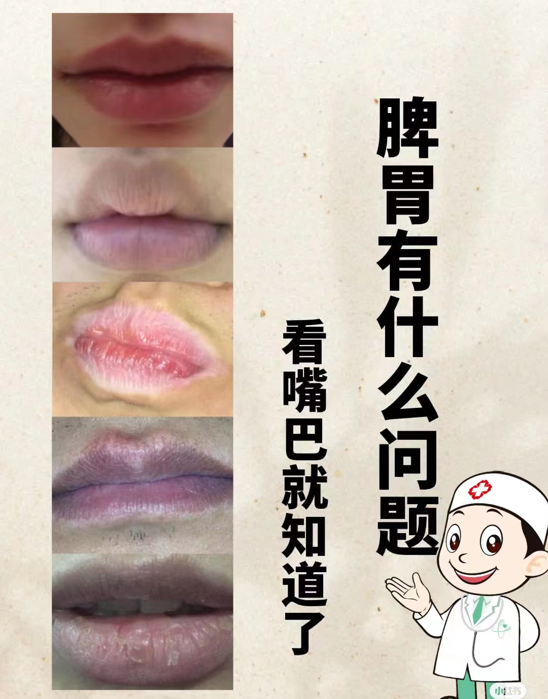 你的脾胃有什么问题,看嘴巴就知道了  脾胃不好有什么症状什么表现呢?