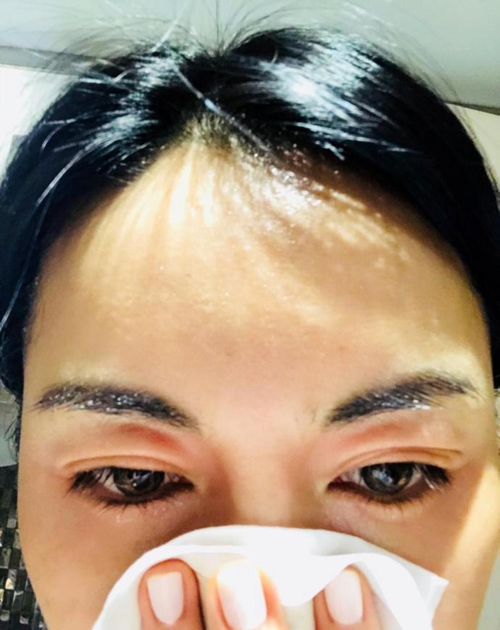 上海美女主持杨乐过敏严重 双眼皮肿成单眼皮,自侃"肿得像鱼"