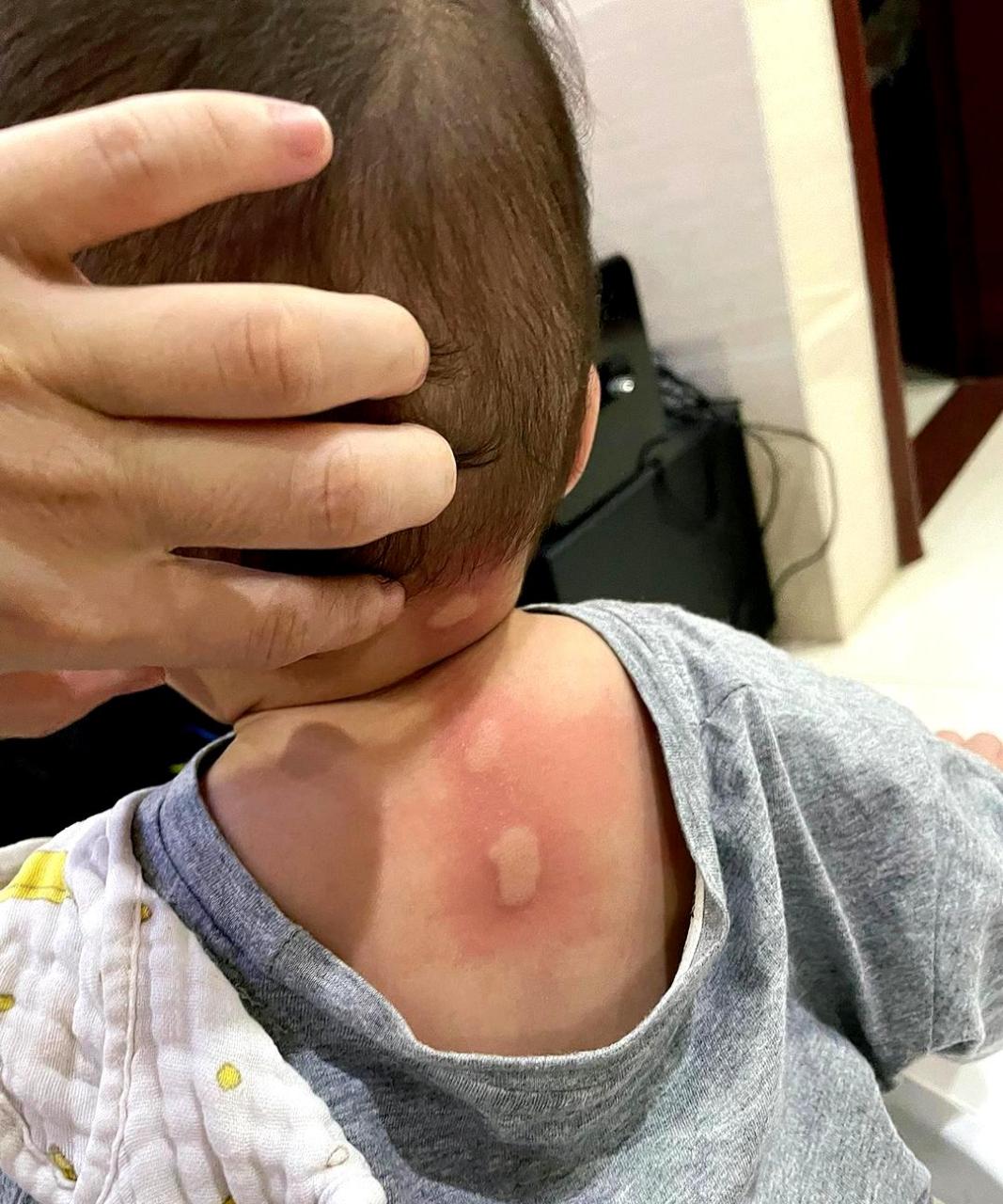 如何有效防止宝宝被蚊子叮咬?因为现在天气多蚊子,宝宝很容易被叮咬.