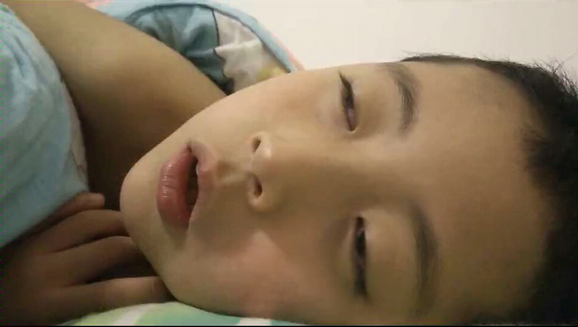 78孩子睡觉半睁眼西医上叫眼睑闭合不全,中医称"睡卧露睛",一般是