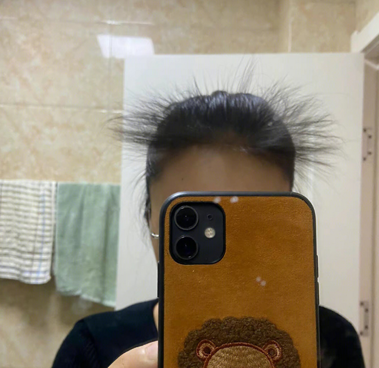 刚睡醒发现炸毛了,难道最后的几根头发也要保不住了 吗?