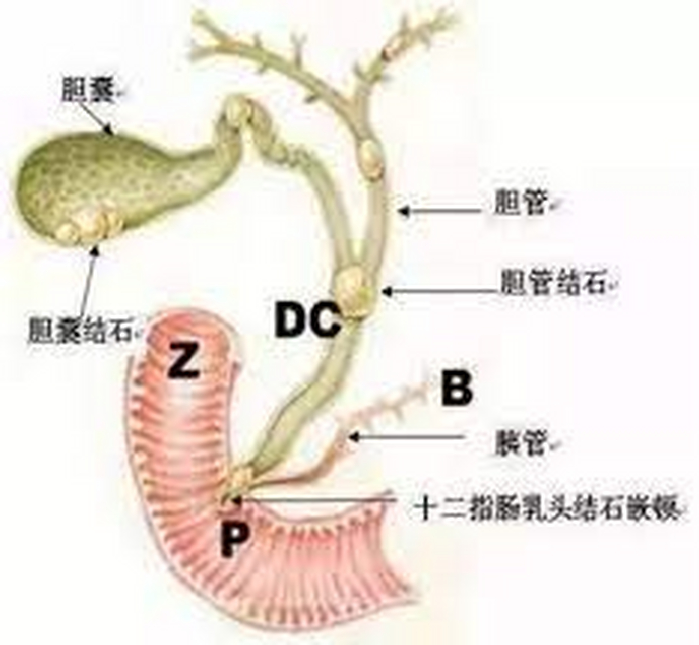 胆囊管胆总管解剖图图片