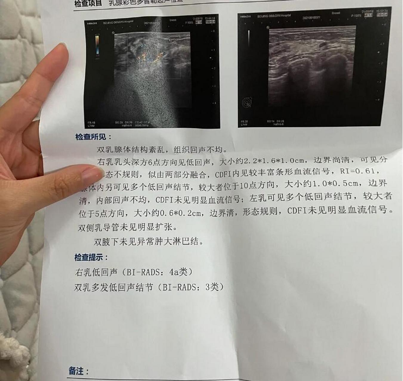4a类乳腺结节,如果不手术的话,用吃药吗?