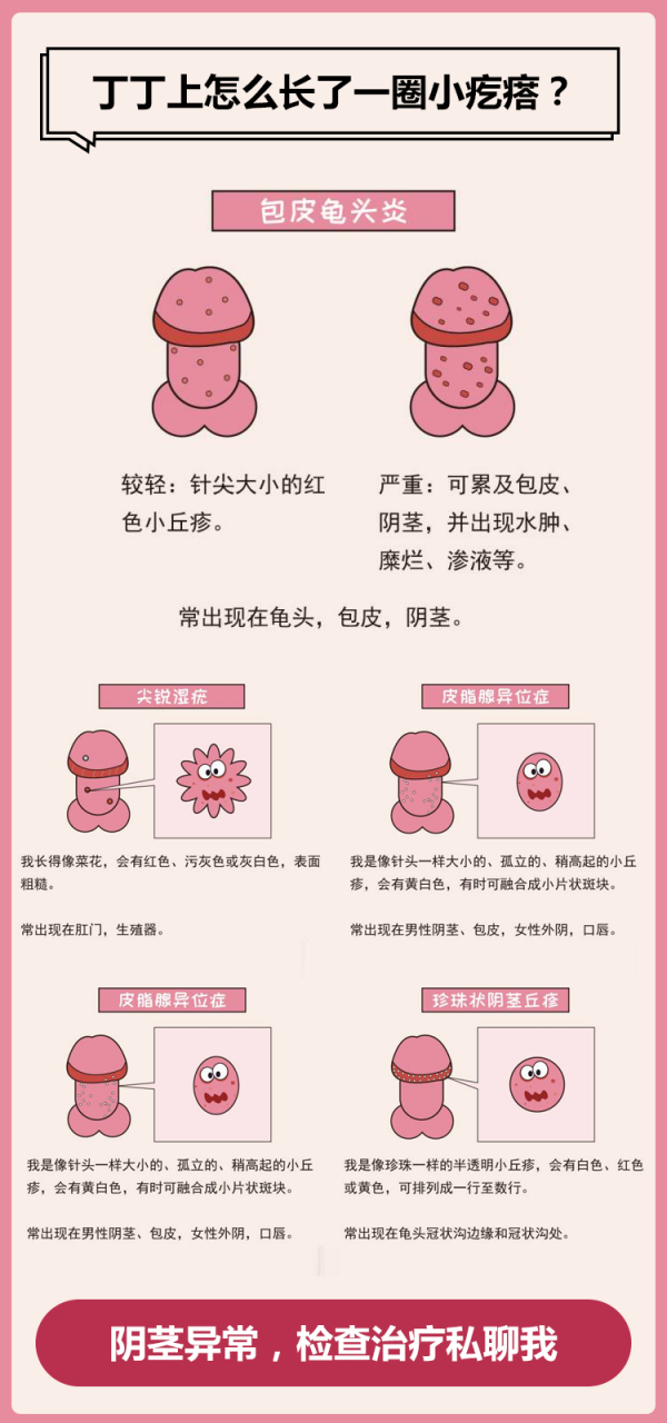 包皮龟头炎#  #泰州东方医院# #泰州东方男科检查58元# #泰州专业