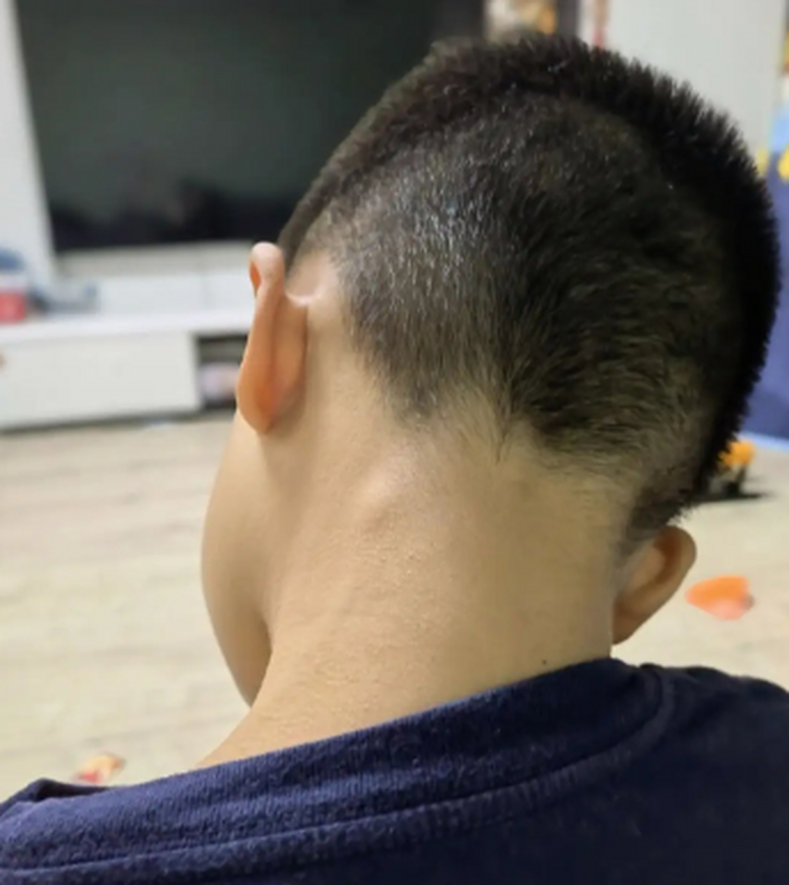 8岁男孩,妈妈帮孩子洗澡的时候发现后脑勺有一个包