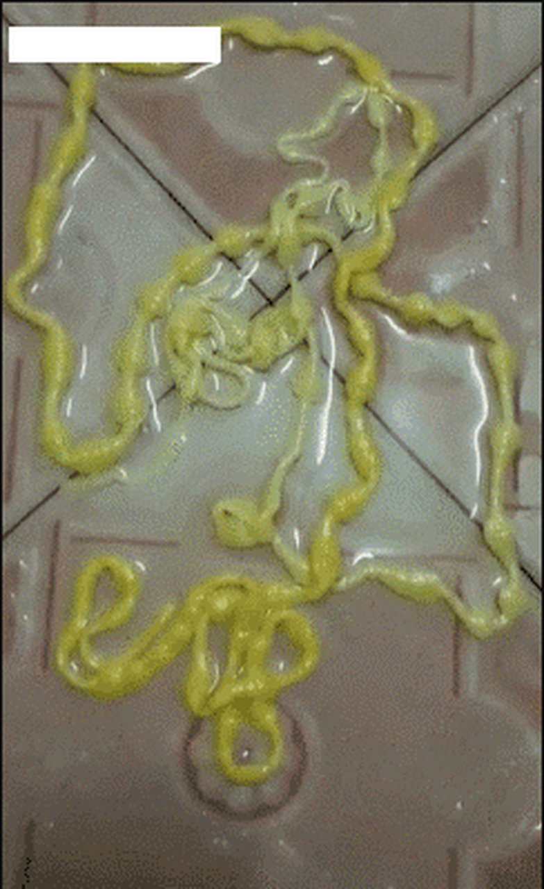 泰国男子大便出一条寄生虫,医生鉴定为牛肉绦虫,一般吃生肉导致.