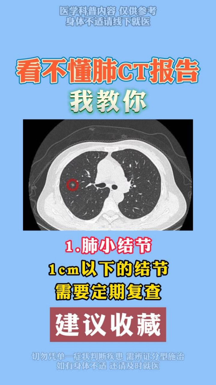 今天9图教会你 #肺结节# #肺部ct报告