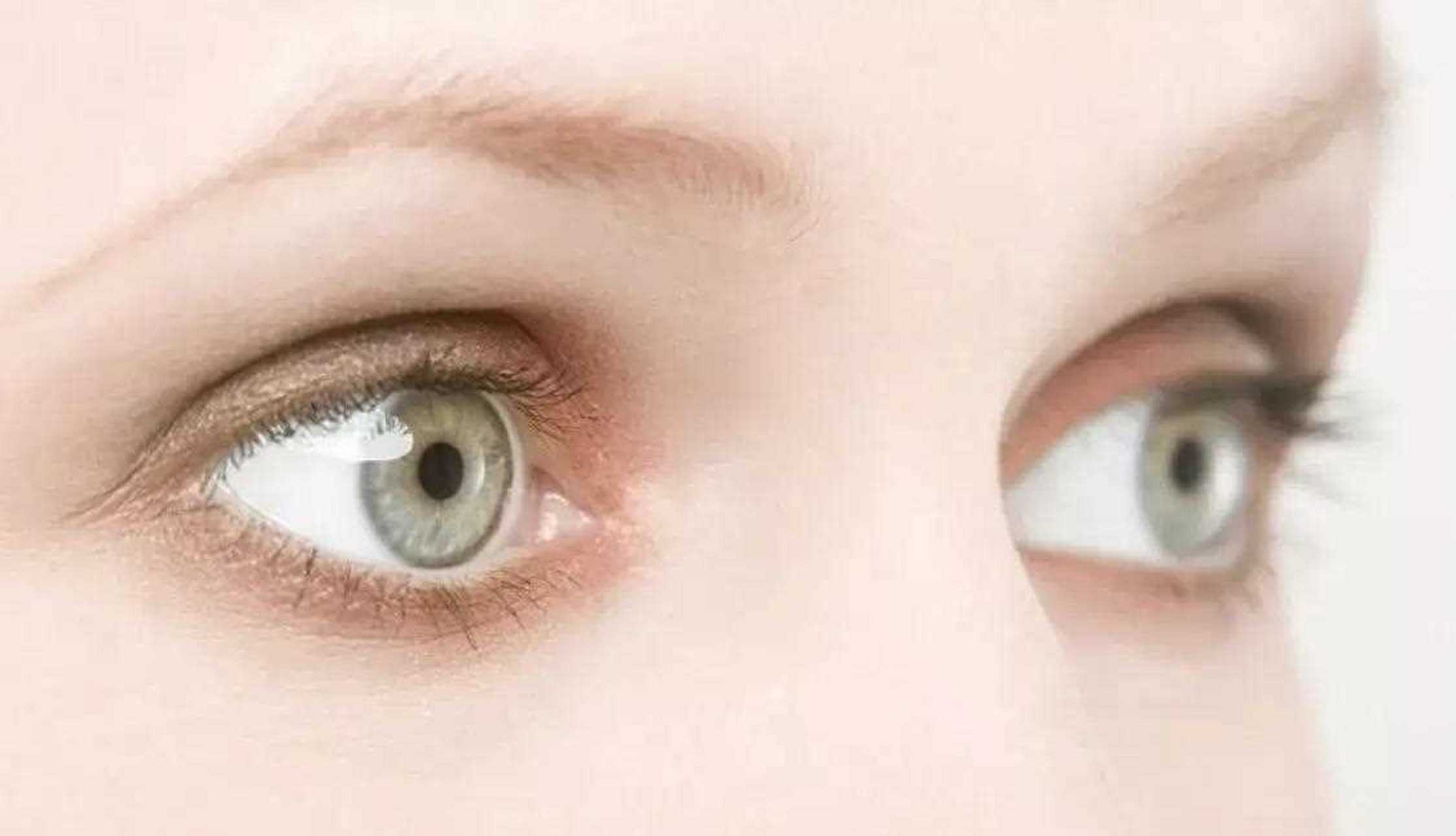 【眼睛酸涩肿胀怎么办?