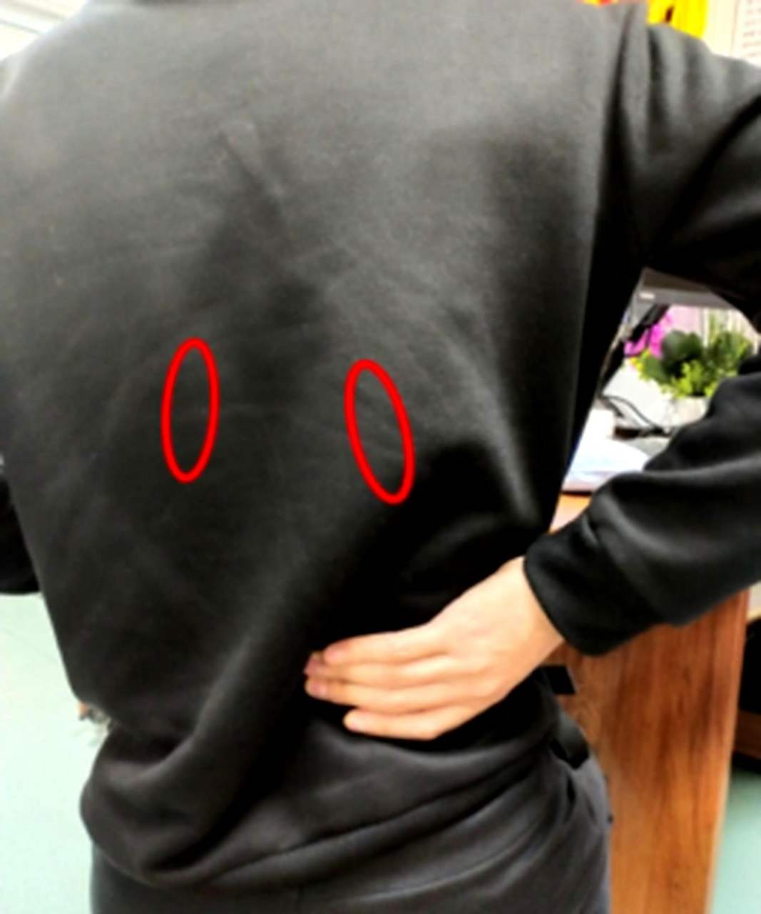 你可能一直把腰疼误认为是肾疼,因为你可能搞错了肾的位置.