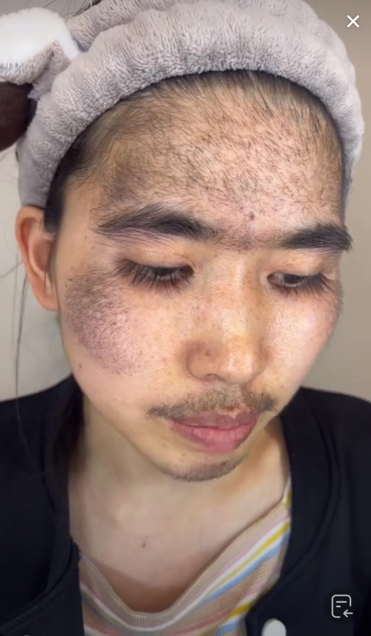 全脸长毛 额头上也长毛