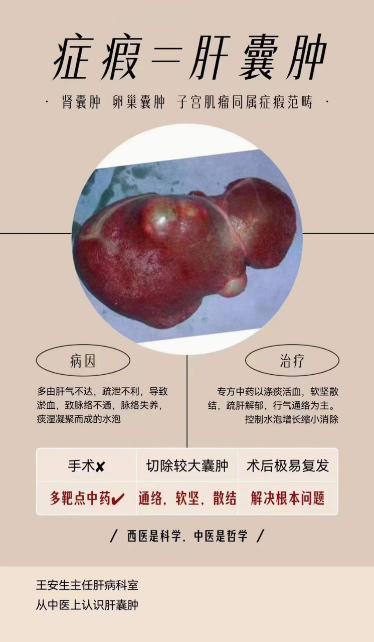 从中医上认识肝囊肿:症瘕zhēng jiǎ 肝囊肿主要是因为先天性因素