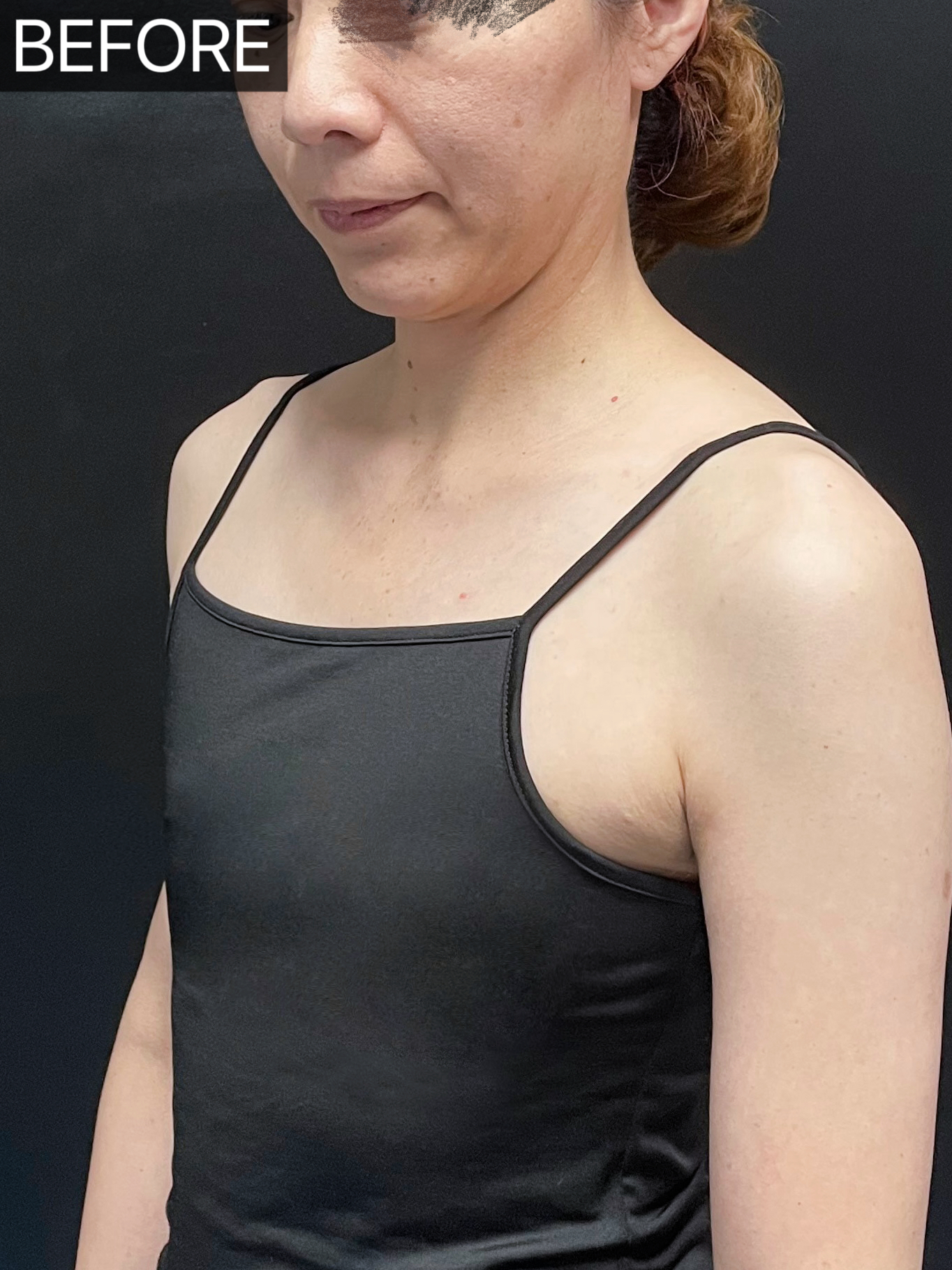 平胸→a ,不仅仅是胸围有了变化,还让她终于感受到了属于女人的自信!