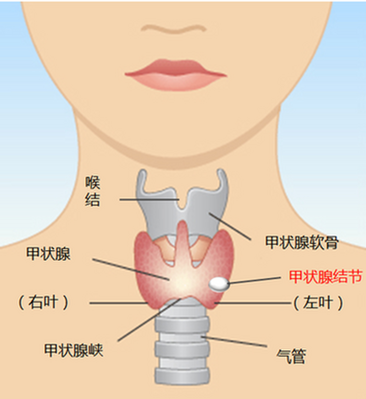 甲状腺分区图图片