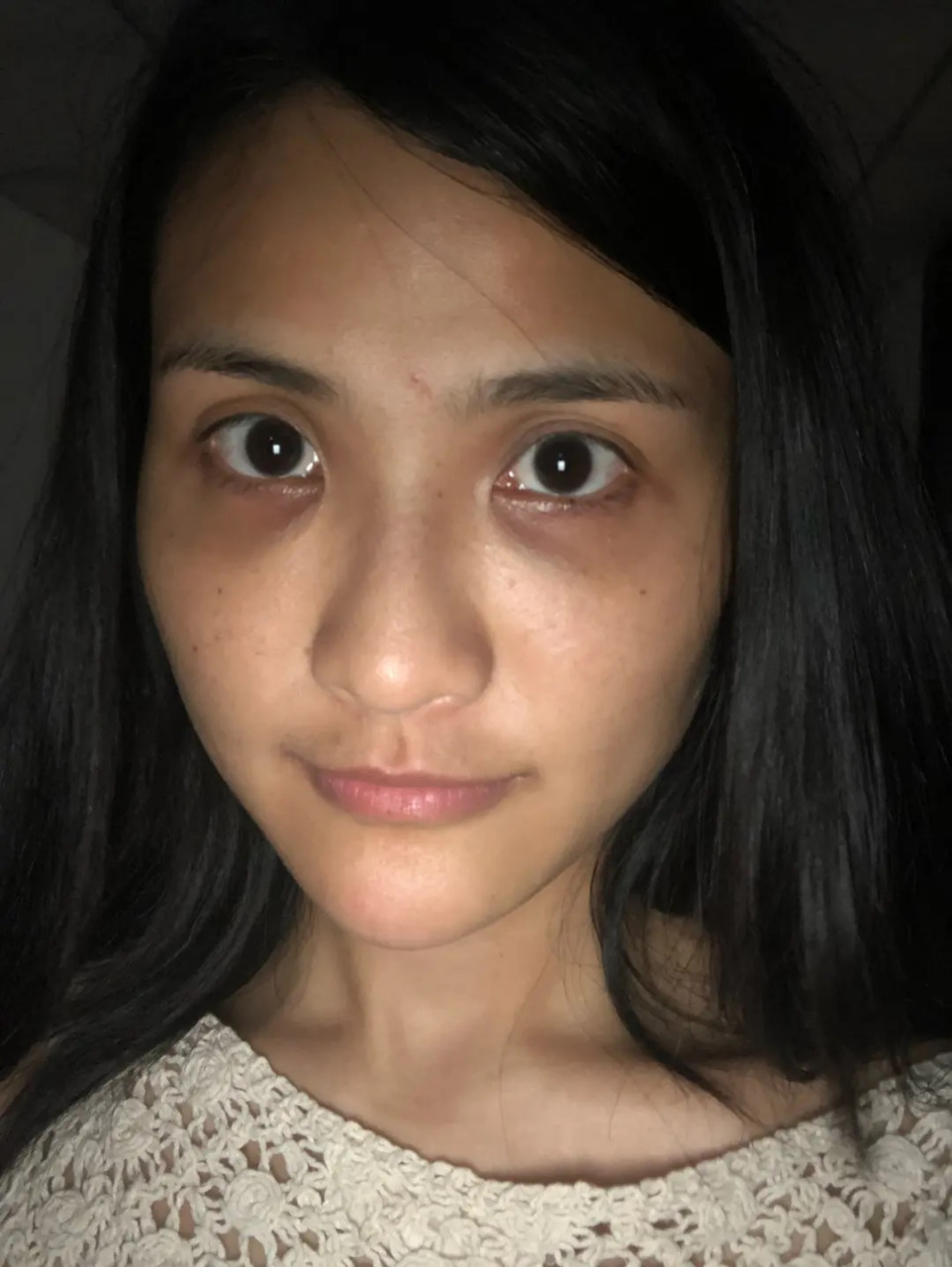 黑眼圈的形成,首先内分泌失调或者肝功能不好很容易形成.