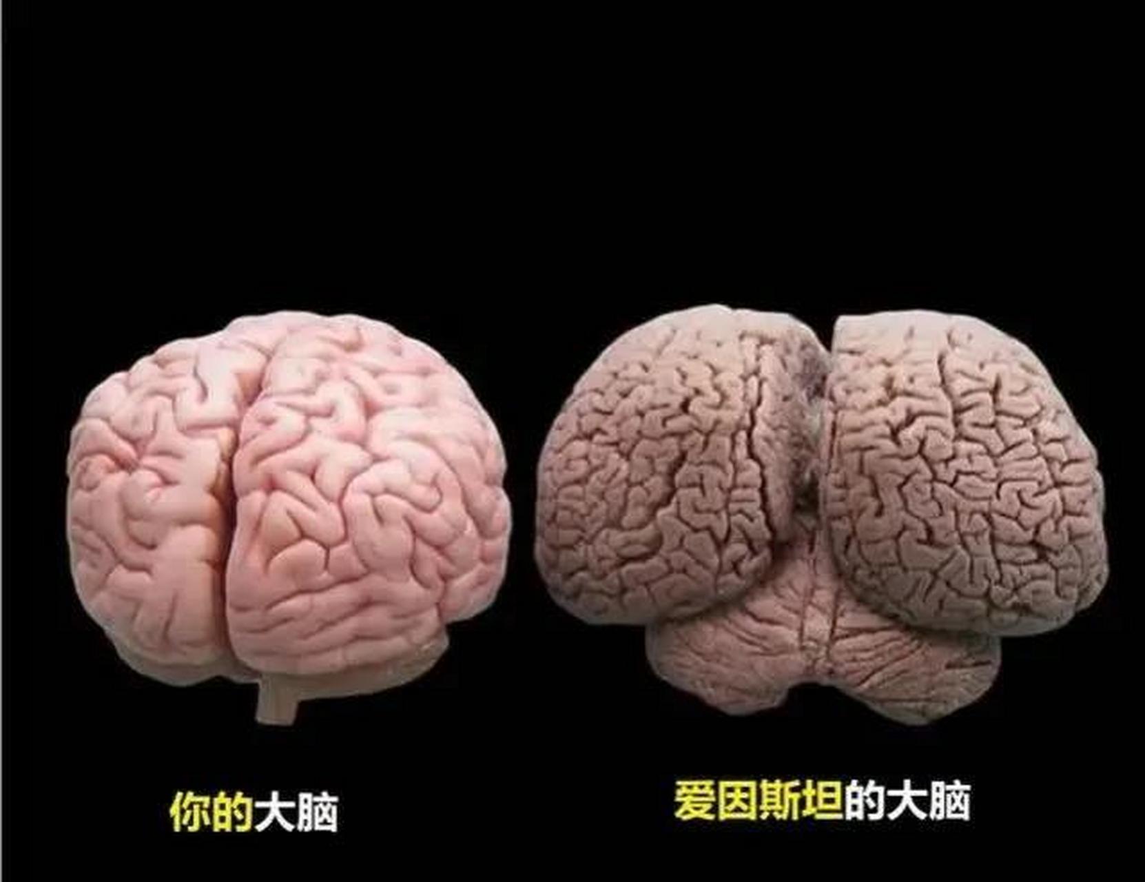 你的大脑和爱因斯坦的大脑有多大区别