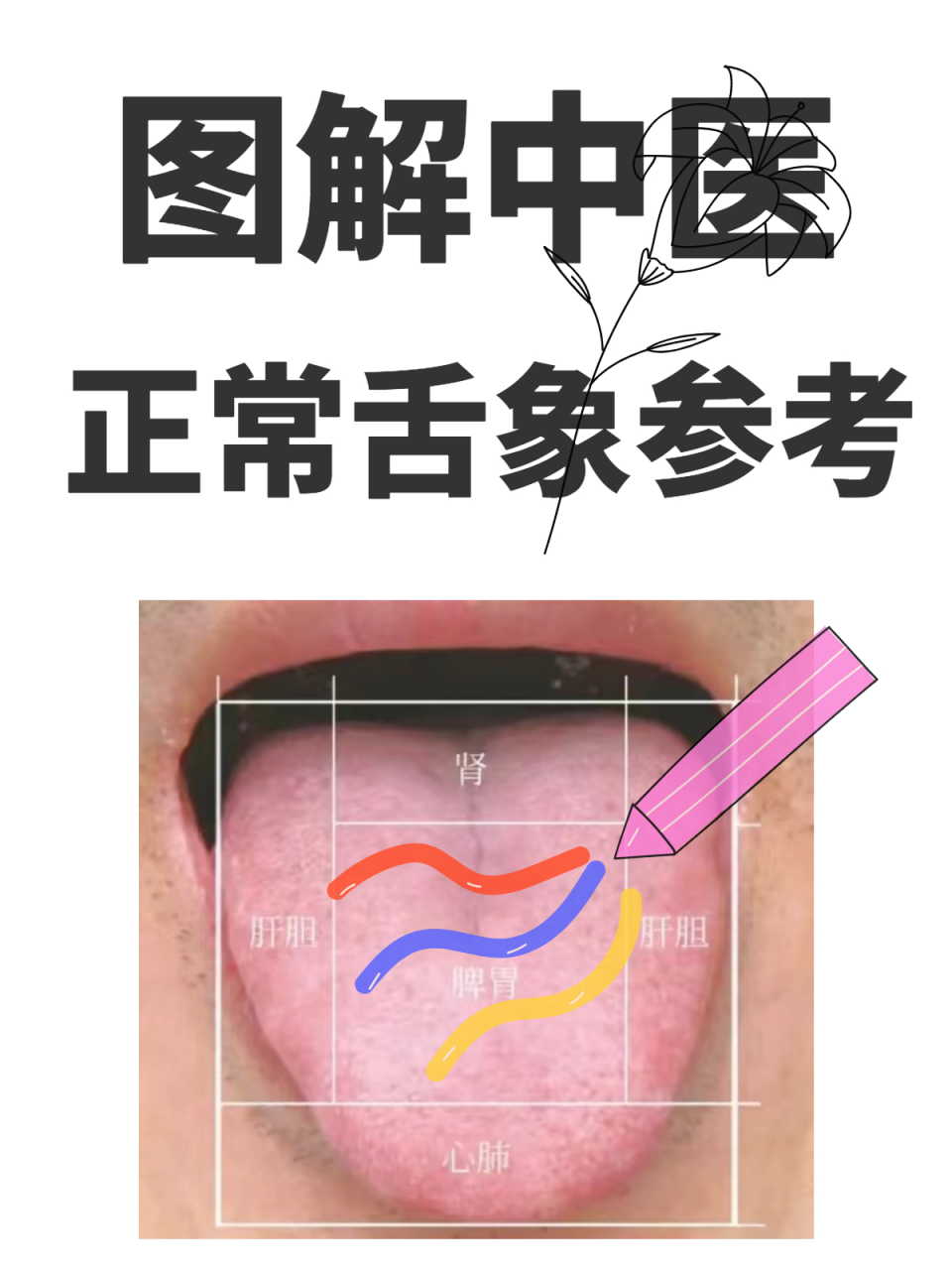 图解中医:四大虚舌象参考