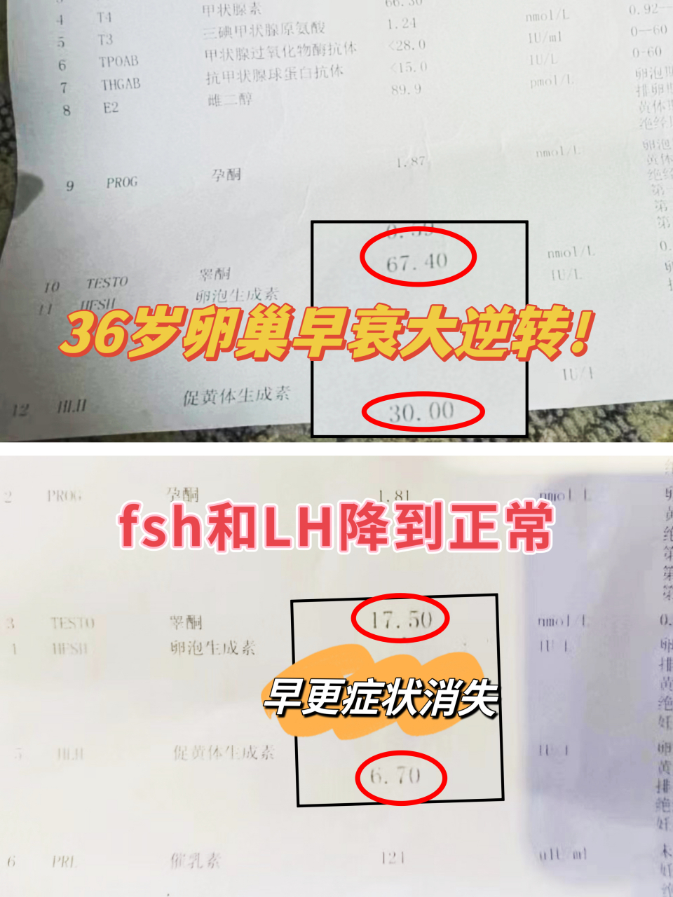 fsh逆襲下降,我很明確的告訴你們,卵巢早衰可以逆!