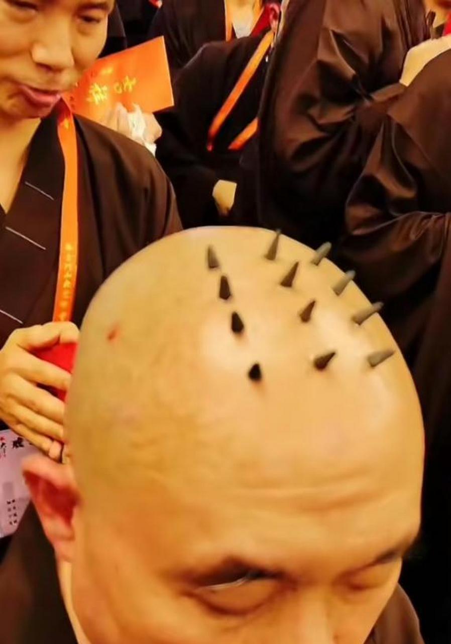 网友:出家人,头顶的戒疤原来是是这样做出来的