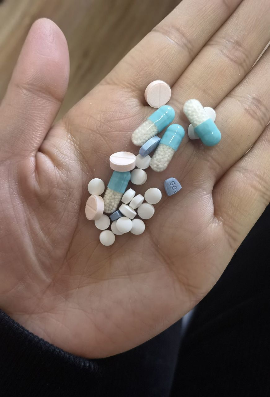 奥氮平不应该成为精神科的万能药物 现在奥氮平似乎已经成为精神科的