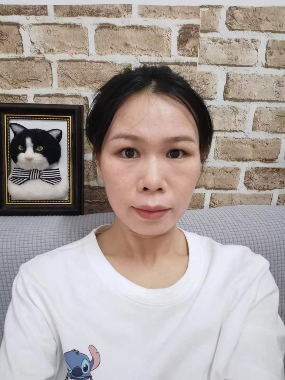 首先,我们需要了解面颊凹陷的原因.