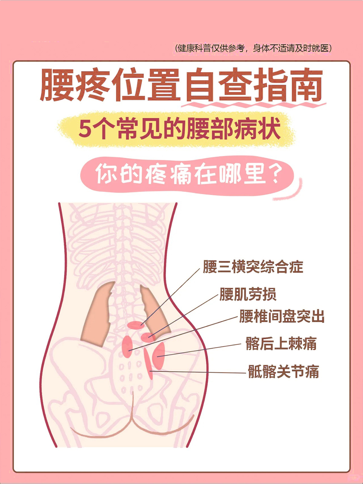 今天这组腰痛自查位置图 帮你做个对照