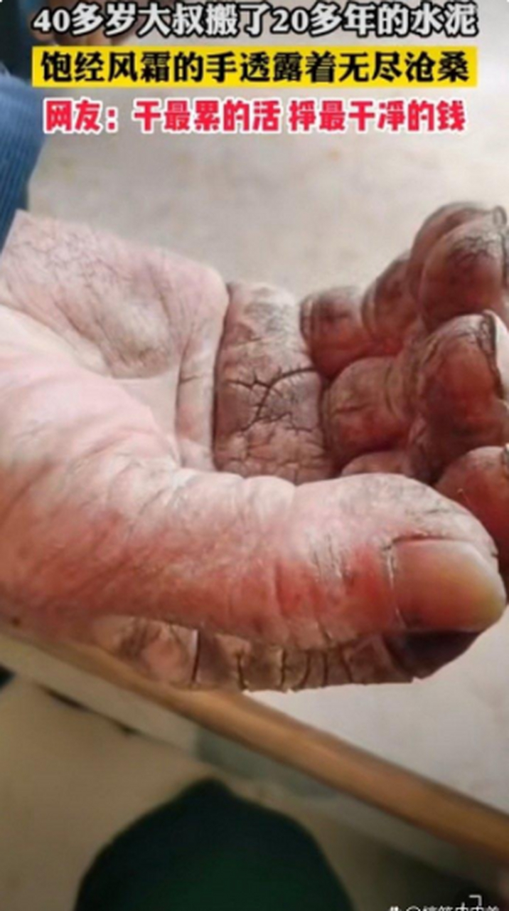 一位40岁大叔搬了20年水泥的手