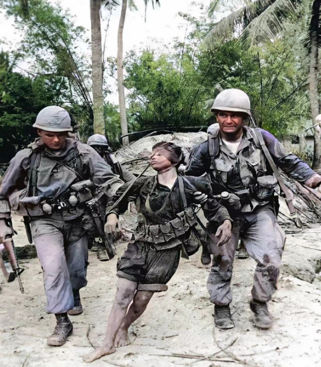 这是越南战争期间发生的真实一幕,一位受伤的越南俘虏在美军的搀扶