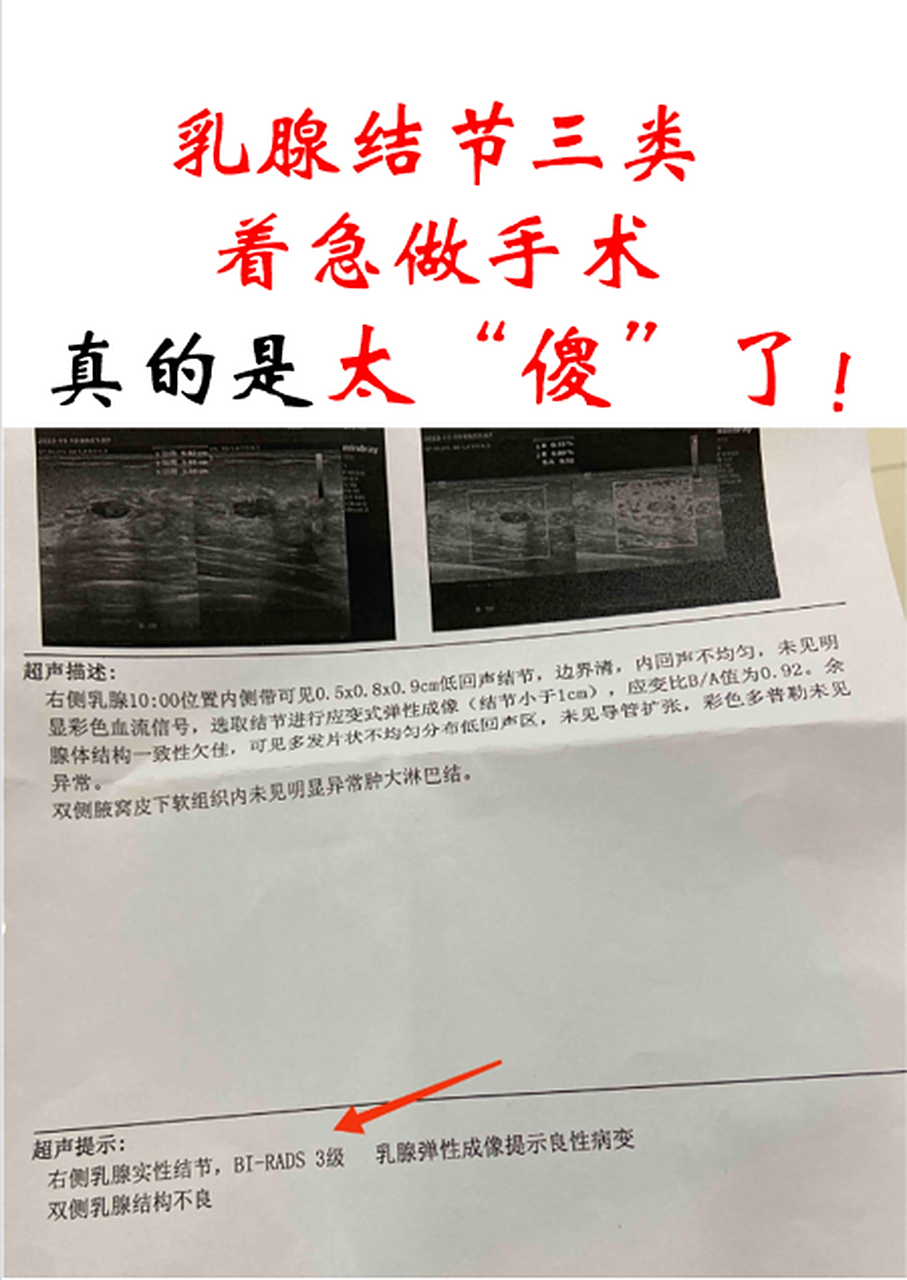乳腺结节三类,着急做手术的真是太傻了!
