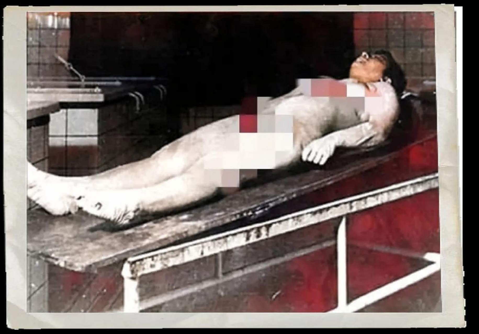 没有任何麻醉,他的骨骼和神经组织被无情地取出,然