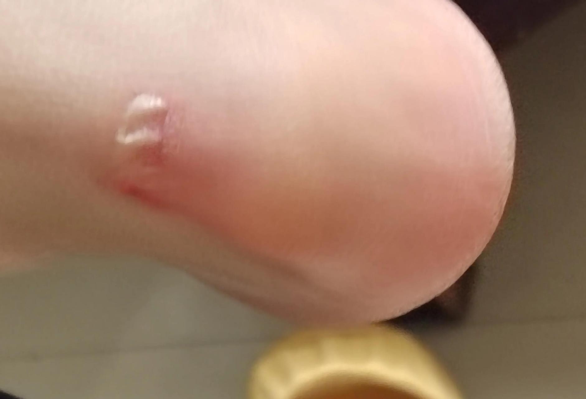 结果,我没有,脚更痛了. 原来这世间,所有事物是共通的:别强求,会受伤!